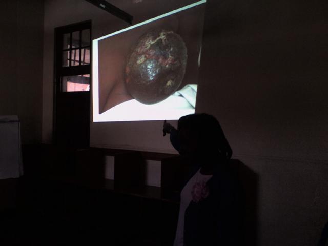 Learning about Breast Cancer...thanks to Mary Onyango, Kenya Breast Helath Programme